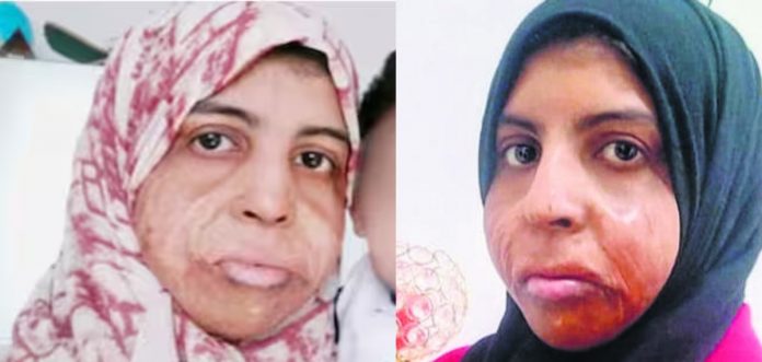 420GgEsuzD2zxeQQyRSdfYa6iPagtZ9DGRf5WDJo