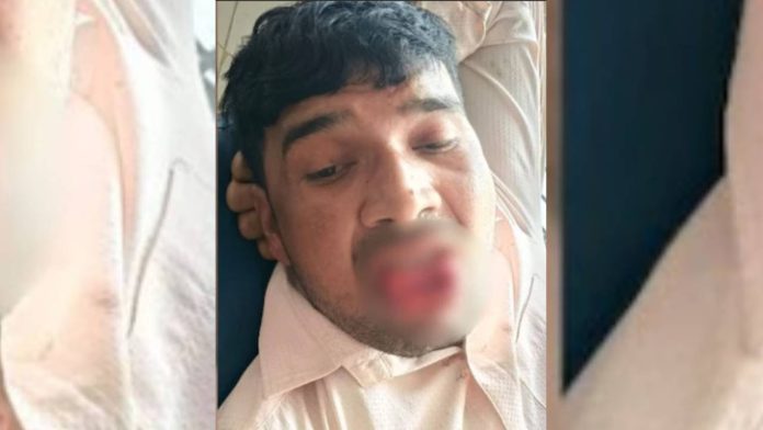 newsmalayalam_2025-11-18_ag1k9om0_Bites-Off-Tongue