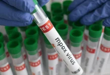 ഇന്ത്യയിലും യുകെയിലും രണ്ട് പുതിയ എംപോക്സ് വൈറസ് വകഭേദം സ്ഥിരീകരിച്ചു