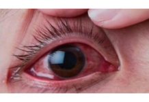 ബാരിക്കേഡില് തട്ടി പത്ത് വയസ്സുകാരന്റെ കണ്ണിന് പരുക്കേറ്റു