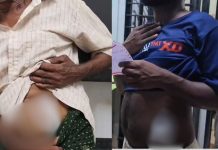 ഉത്സവത്തിനിടെ തര്ക്കം: കോമരത്തിന്റെ വാളുപയോഗിച്ച് വെട്ടി; മൂന്ന് പേര് ആശുപത്രിയില്,